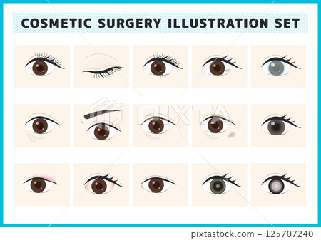 Cosmetic surgery, eye symptoms, and illness illustration material set Cosmetic surgery, eye symptoms, and illness illustration material set 125707240