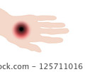 May_3_anthrax 125711016