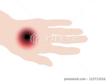 May_3_anthrax 125711016