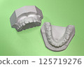 Plaster dental model, dental image, orthodontic model 125719276