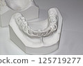 Plaster dental model, dental image, orthodontic model 125719277