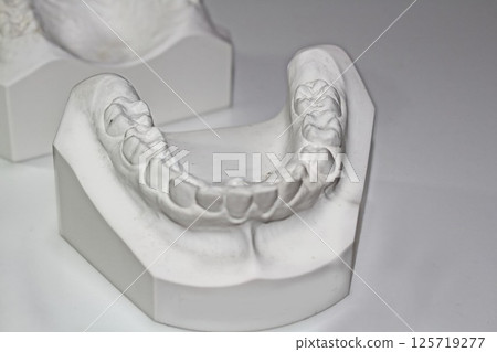 Plaster dental model, dental image, orthodontic model 125719277