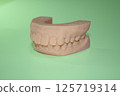Dental 3D model for aligner correction, orthodontic model 125719314