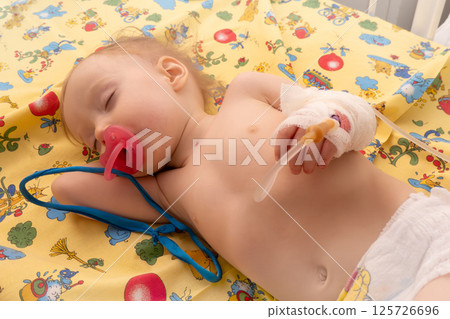 Baby girl sick and sleeping on patient bed at the hospital. Saline intravenous or (IV)drip in baby patient hand. Poor baby looks tired and exhausted.IV fluid replacement or correcting the dehydration. 125726696