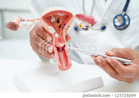 Uterus, doctor holding human anatomy model for study diagnosis and treatment in hospital. Uterus, doctor holding human anatomy model for study diagnosis and treatment in hospital. 125729204