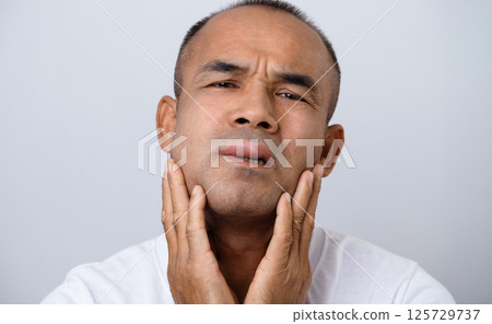 The man has facial swelling due to an allergic reaction to triggers such as insect bites stings 125729737