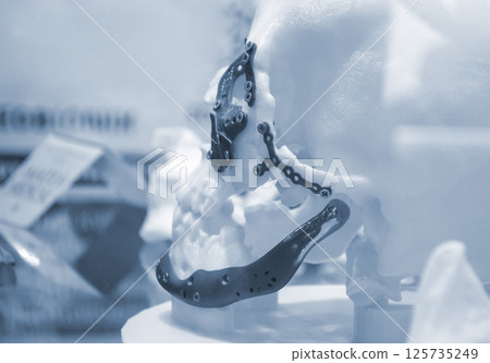 Prototype of human skull from white plastic with titanium implants in form of plates and surgical templates printed on 3D printer. Biointegrated prosthesis. Medicine medical Prototype of human skull from white plastic with titanium implants in form of plates and surgical templates printed on 3D printer. Biointegrated prosthesis. Medicine medical 125735249