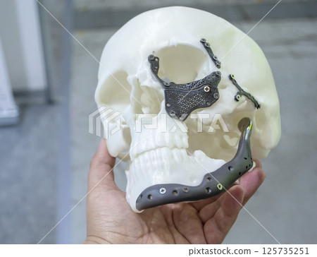 Man holding in hand proto-human skull from white plastic with titanium implants in form of plates and surgical templates printed on 3D printer. Biointegrated prosthesis Man holding in hand proto-human skull from white plastic with titanium implants in form of plates and surgical templates printed on 3D printer. Biointegrated prosthesis 125735251