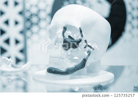 Prototype of human skull from white plastic with titanium implants in form of plates and surgical templates printed on 3D printer. Biointegrated prosthesis. Medicine medical 125735257