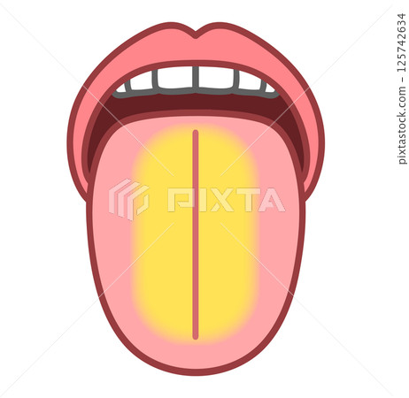 黃舌，舌診，病舌圖 125742634