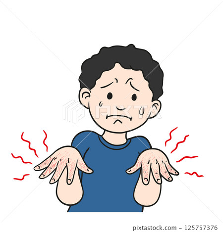 man with burnt hand, Suffering from Cracks man with burnt hand, Suffering from Cracks 125757376