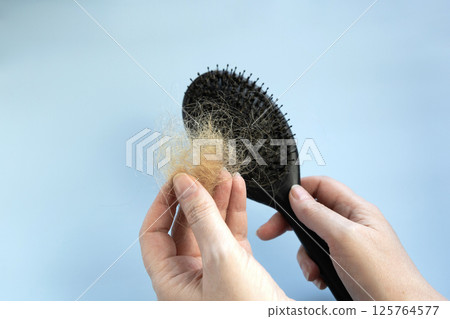 Woman holding a hair brushes with lots of hair falling out. Hair loss concept 125764577