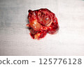 Removed metastatic brain tumor lies on white medical gauze, showcasing surgical procedure 125776128