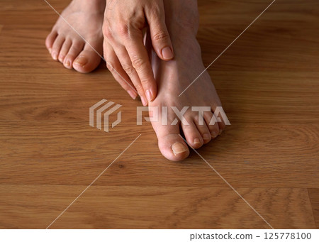 Close-up of a woman s foot with hallux valgus bunion and signs of toenail fungus. Her hand gently touches the deformed big toe, illustrating common foot problems and the need for medical care. 125778100