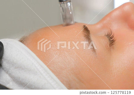 Microneedle RF lifting procedure. A cosmetologist performs a facial rejuvenation procedure on a woman. Hardware cosmetology. Microneedle RF lifting procedure. A cosmetologist performs a facial rejuvenation procedure on a woman. Hardware cosmetology. 125778119