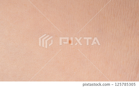 Skin mole spot closeup. Human birthmark, nevus macro texture Skin mole spot closeup. Human birthmark, nevus macro texture 125785305
