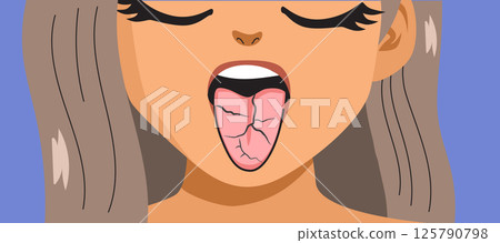 Close Up of Woman With Fissured Tongue Cartoon Vector Illustration 125790798