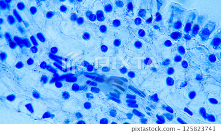 Lillium 0vary 125823741