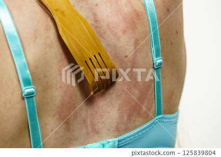 Woman scratching her itchy back using scratcher Woman scratching her itchy back using scratcher 125839804