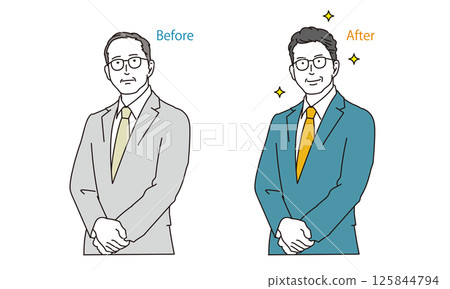 Before and after of men with thinning hair and hair problems 125844794