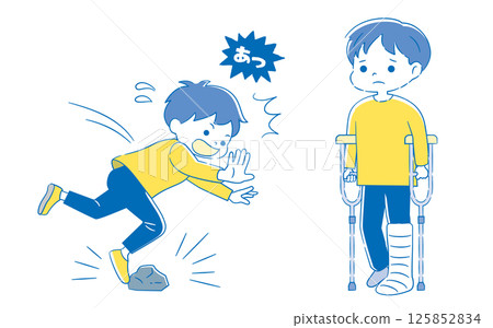 兒童摔倒受傷的插圖 2C 125852834