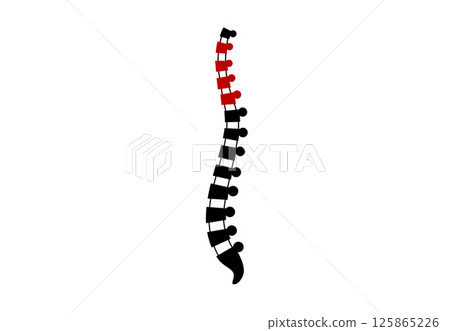 Scoliosis medical poster 125865226