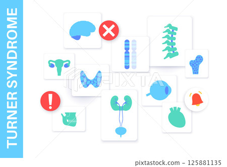 Turner syndrome poster 125881135