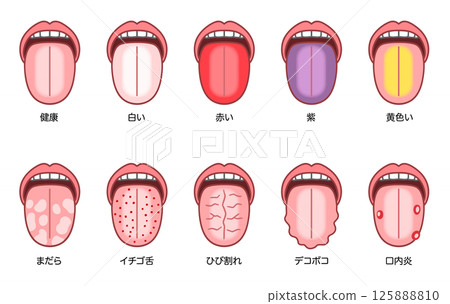 Tongue diagnosis, tongue with various symptoms Tongue diagnosis, tongue with various symptoms 125888810