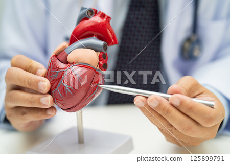 Cardiovascular disease CVD, Asian doctor holding human anatomy model for learn and treat heart disease. 125899791