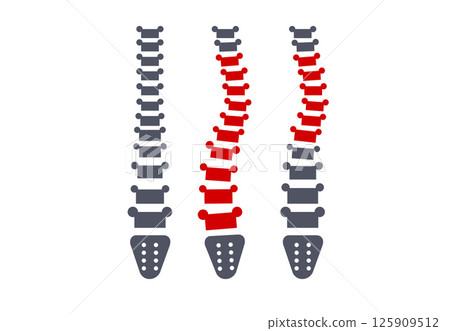 Scoliosis medical poster 125909512