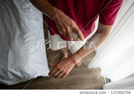 Man spraying spf healing cream on burned arm after harsh sun. Overexposure after careless outing 125968706
