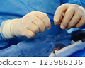 Operations to remove blood clots. Prevention of blood clots. Endovascular surgery. Surgical interventions on blood vessels. 125988336