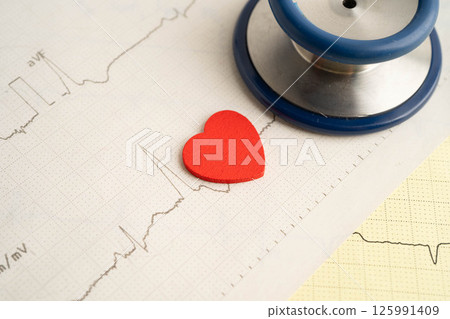 Stethoscope on electrocardiogram ECG, heart wave, heart attack, cardiogram report. Stethoscope on electrocardiogram ECG, heart wave, heart attack, cardiogram report. 125991409