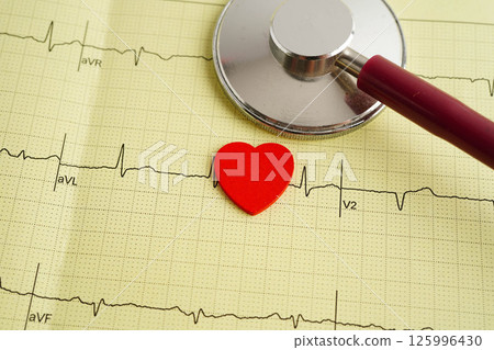 Stethoscope on electrocardiogram (ECG), heart wave, heart attack, cardiogram report. Stethoscope on electrocardiogram (ECG), heart wave, heart attack, cardiogram report. 125996430