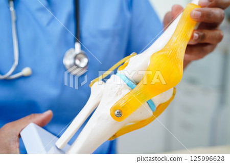 Asian doctor holding spinal nerve and bone model, Lumbar spine displaced herniated disc fragment for treatment medical in the orthopedic department. 125996628