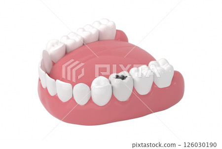 aching, damage, toothache 126030190