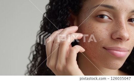 Young woman with synthetic skin graft on face, illustrating healing, dermatological innovation, regenerative medicine, and advanced skincare for pigmentation or trauma recovery. 126035047