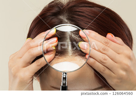 A woman's scalp is magnified with a loupe. 126064560