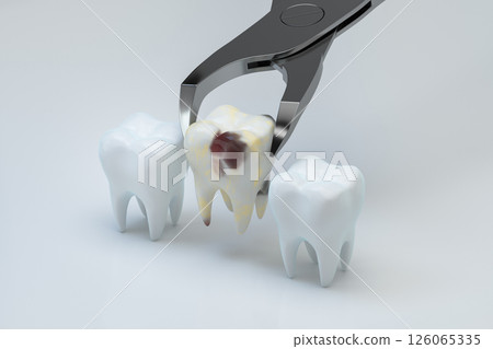 cutbacks, out, pull 126065335