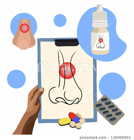 Vector isolated illustration of nasal congestion. Sign of sinusitis. Treatment of sinusitis and sinusitis. Cold. A mild cold. Vector isolated illustration of nasal congestion. Sign of sinusitis. Treatment of sinusitis and sinusitis. Cold. A mild cold. 126068901