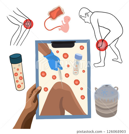 Vector isolated illustration of stem cell treatment. Stem cells in a test tube. Stem cells are injected into the knee. 126068903