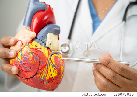 Cardiovascular disease CVD, Asian doctor holding human anatomy model for learn and treat heart disease. Cardiovascular disease CVD, Asian doctor holding human anatomy model for learn and treat heart disease. 126073036