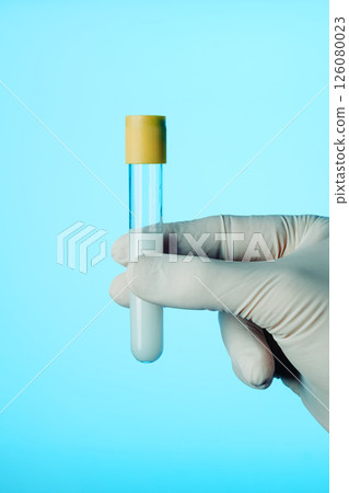 healthcare worker with a test tube with some semen 126080023