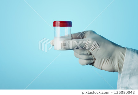 man with a sterile container with semen 126080048