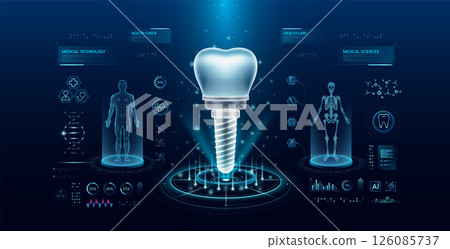 Dental implant health care technology with scan virtual interface hologram style. X ray and MRT human body examination. Medical diagnostic with HUD, UI, GUI. Analysis in futuristic laboratory. Vector  126085737