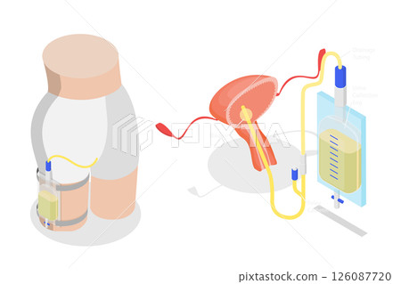 3D Isometric Flat  Illustration of Drainage Bladder, Flexible Rubber Urine Bag For Bladder Infections Treatment 126087720
