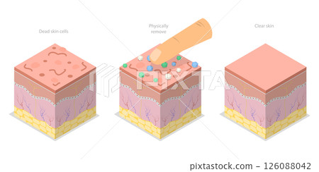 3D Isometric Flat Illustration of Skin Peeling, Mechanical Exfoliation For Skin Renewal 3D Isometric Flat Illustration of Skin Peeling, Mechanical Exfoliation For Skin Renewal 126088042
