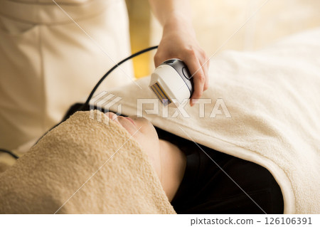 鬍鬚除毛治療影像 126106391