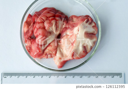 Detailed view of sliced beef brain in transparent dish on white lab surface with visible inner structures and ruler. Anatomical medical sample shown in scientific sterile environment. Detailed view of sliced beef brain in transparent dish on white lab surface with visible inner structures and ruler. Anatomical medical sample shown in scientific sterile environment. 126112395