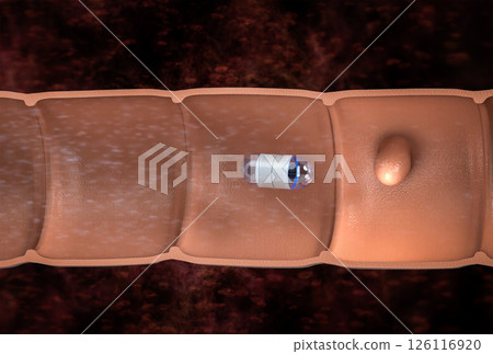 Capsule endoscopy in intestine cutaway 126116920